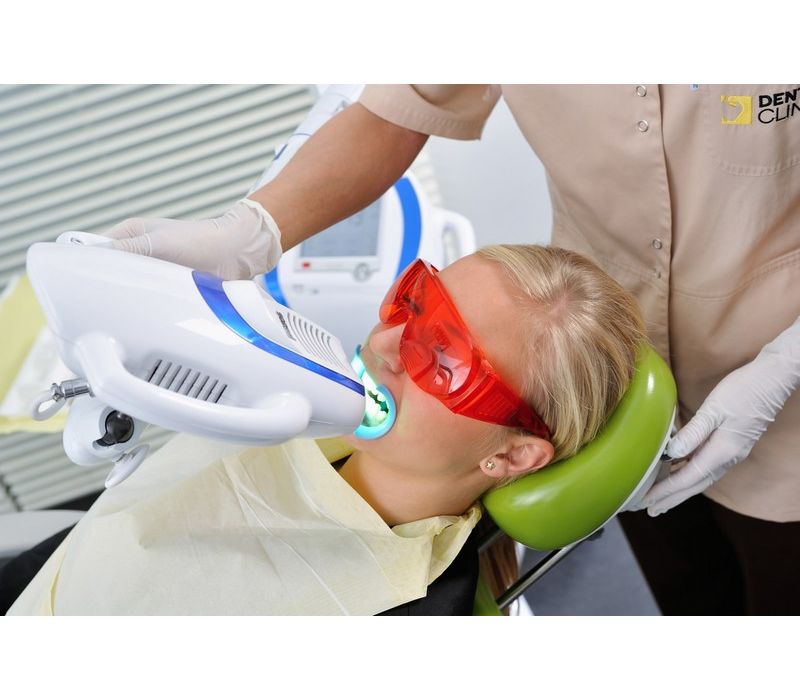Beyond Polus - мультифункциональная комплексная система профессионального отбеливания зубов